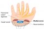 carpal tunnel syndrome surgery