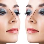 Rhinoplasty-Guide