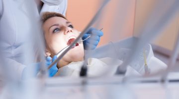 Everything You Need To Know About Root Canals