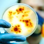 How can We Avoid Infection by Bacteria